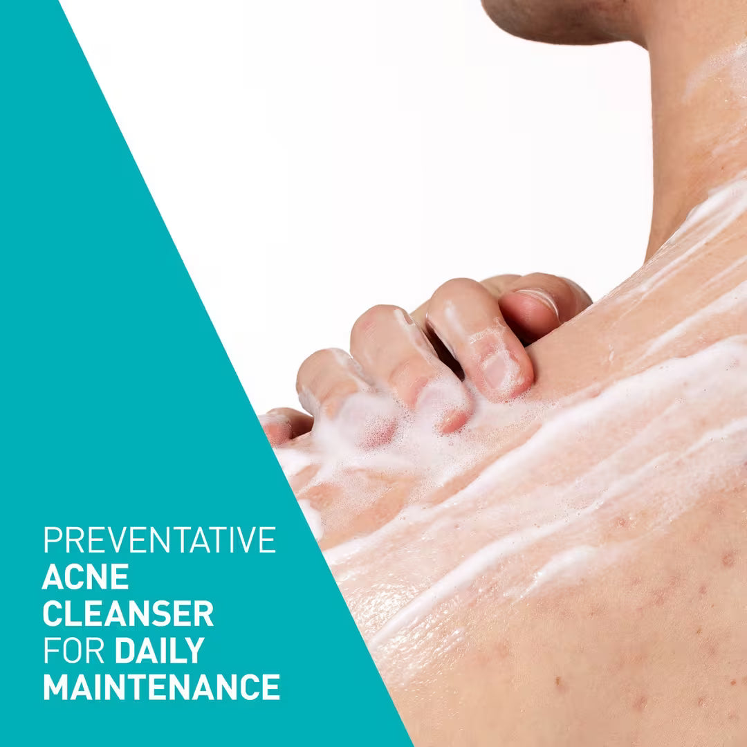 Acne Control Cleanser