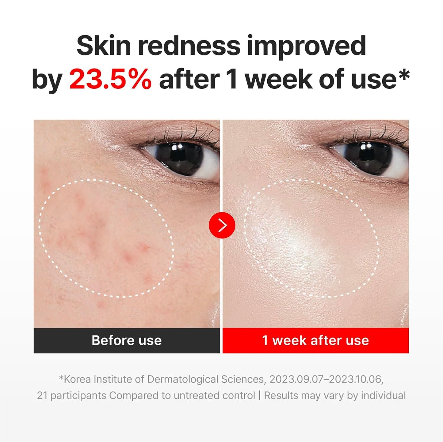 Centella Firming Renewal Cream