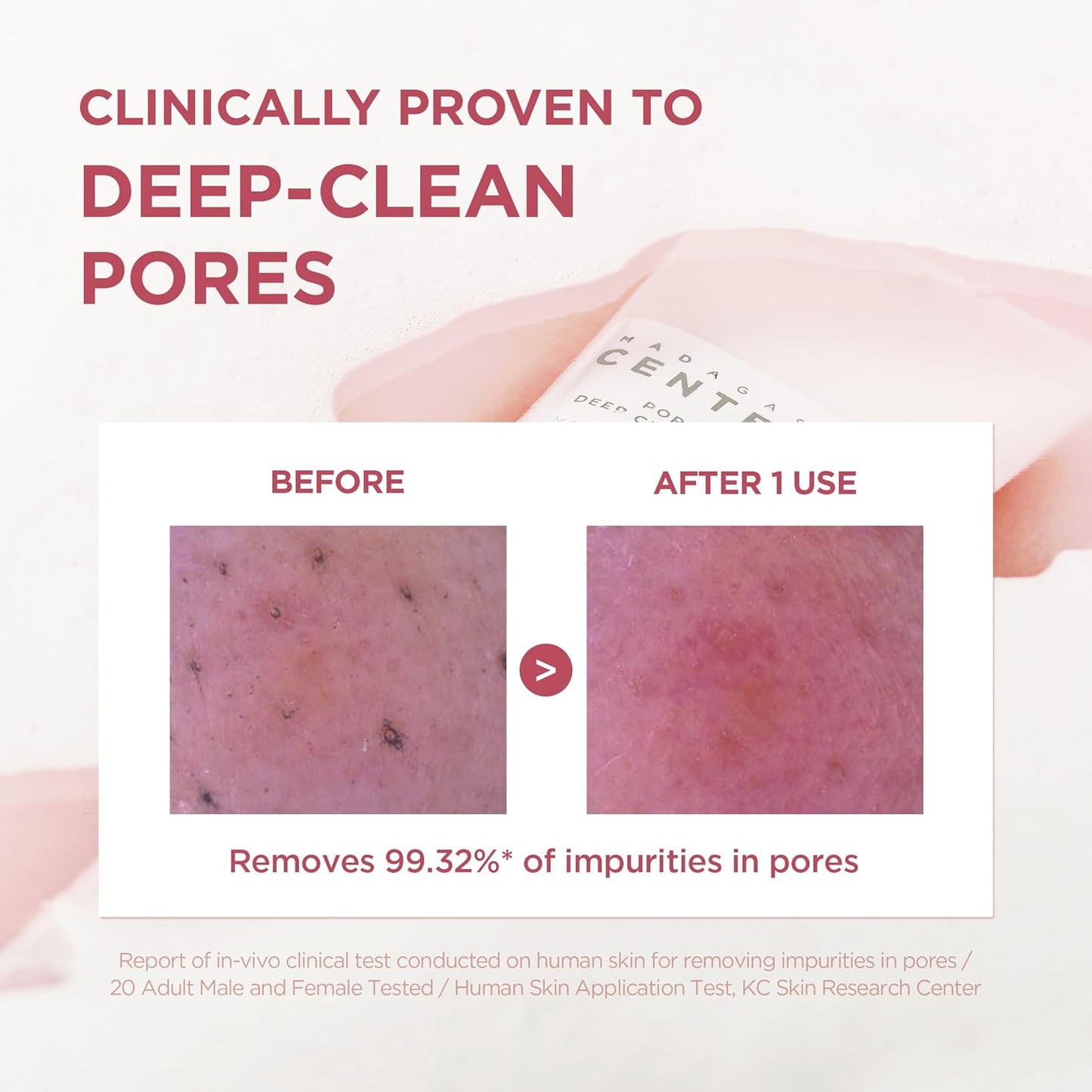 Centella Poremizing Deep Cleansing Foam