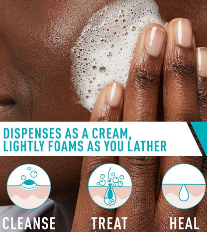 Acne Control Cleanser