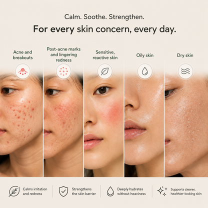 Breakout Recovery Cream