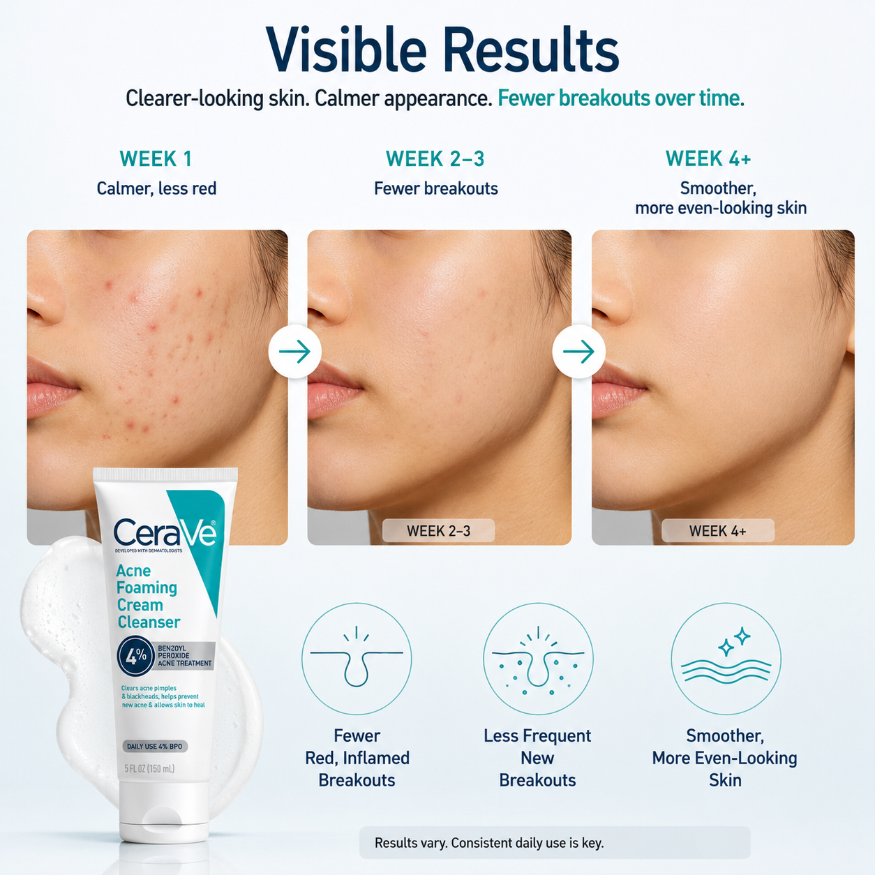 Acne Control Cleanser