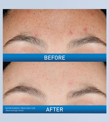 Resurfacing Retinol Serum